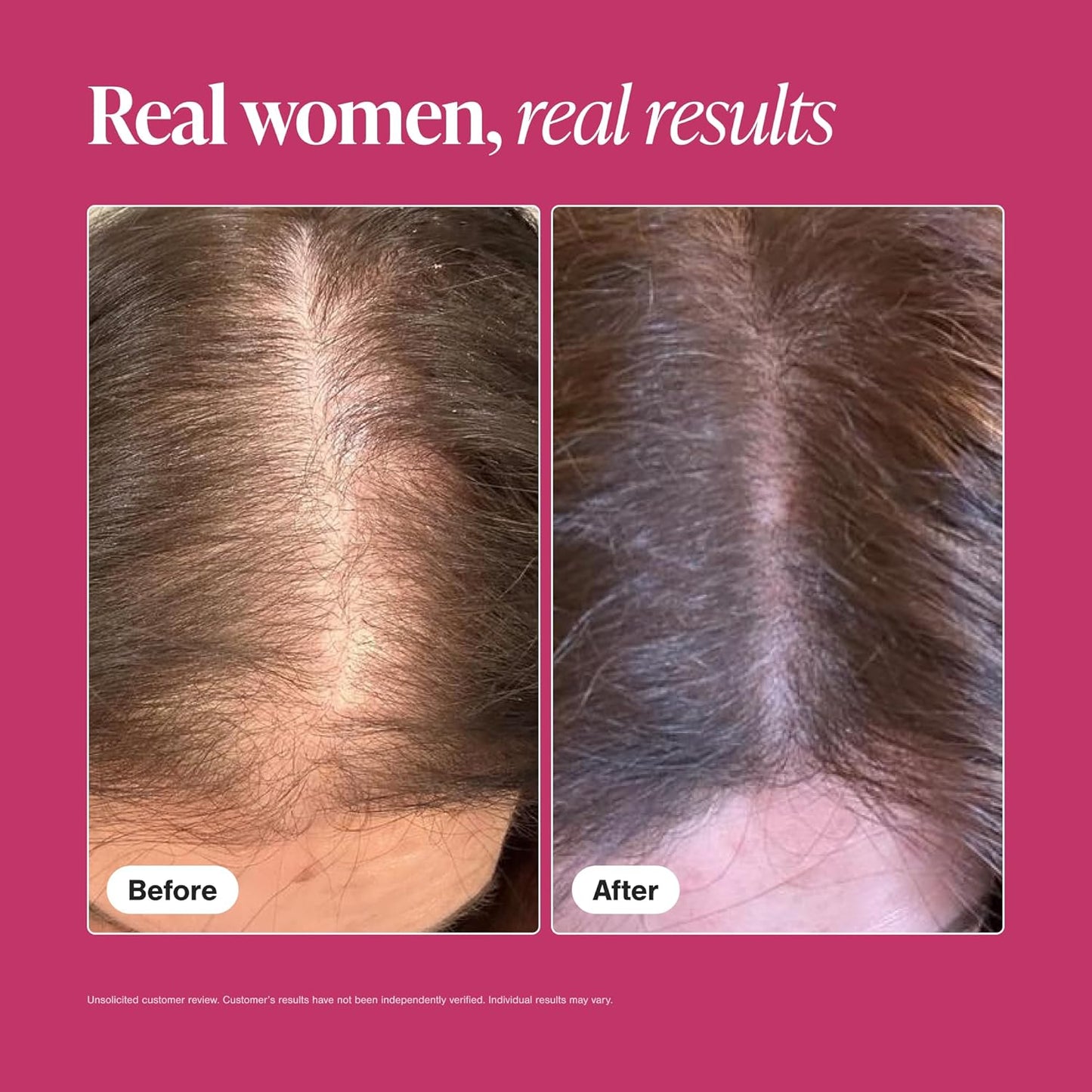 Before and after comparison of hair growth on a pink background with text 'Real women, real results'.