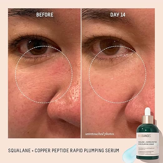 Before and after comparison of a face with a serum bottle labeled 'Biossance' on a beige background.
