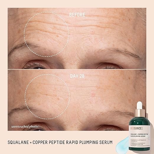 Before and after comparison of a face with wrinkles, featuring a serum bottle labeled 'Biorassance'.
