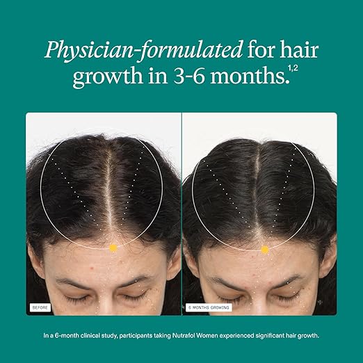 Before and after comparison of hair growth with text about physician-formulated product for hair growth.