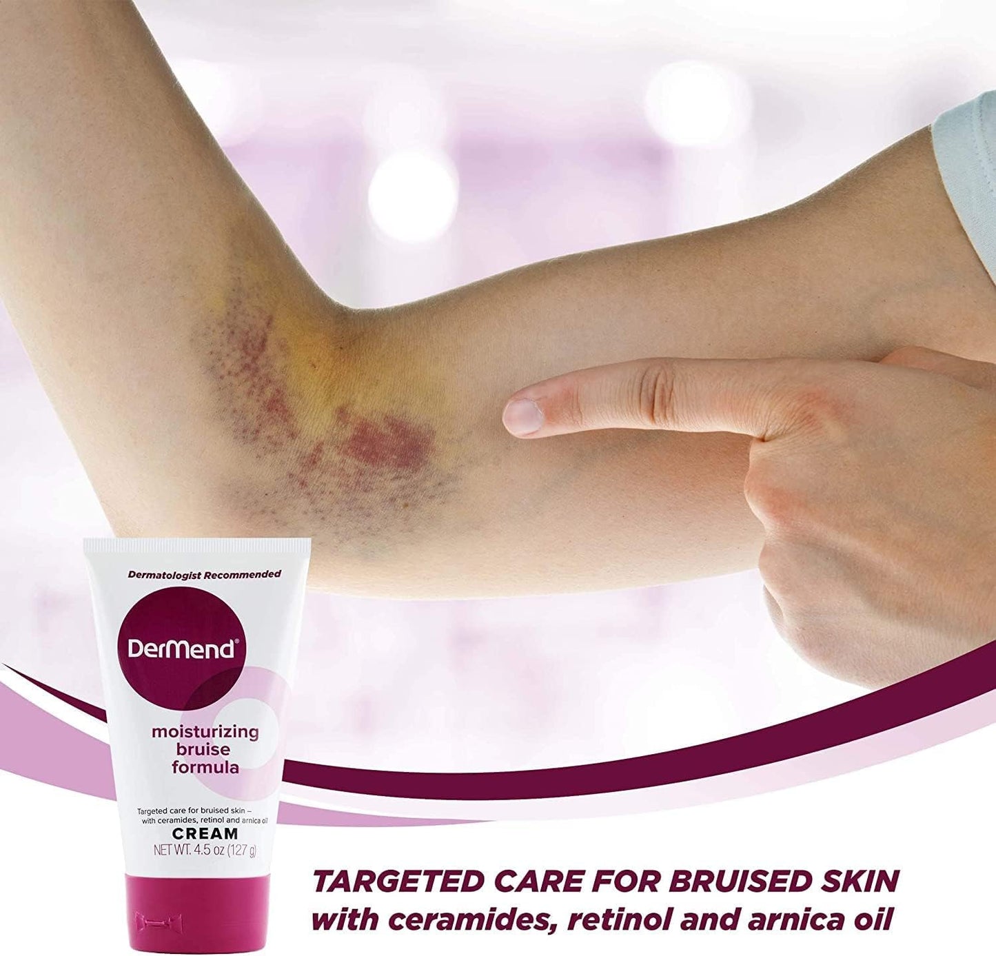 Tube of Dermend moisturizing bruise formula cream with a bruised arm in the background