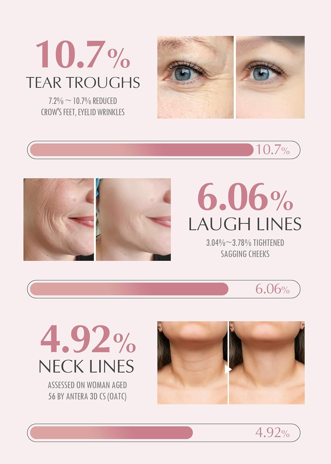 Facial aging indicators with percentages and before-and-after images on a white background