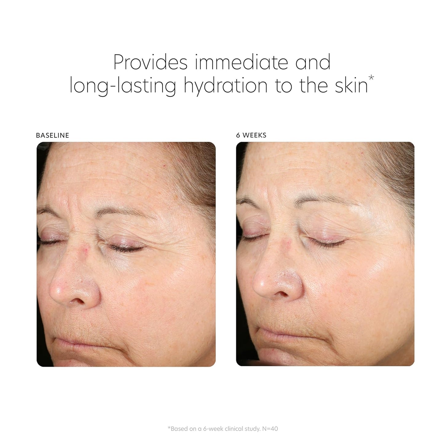 PCA Skin Hyaluronic Acid Boosting Serum – 1 fl oz (30 mL)