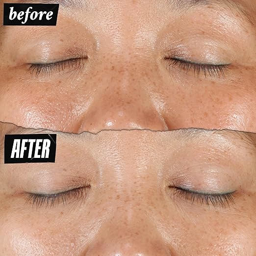 Kiehl's Clearly Corrective Dark Spot Solution