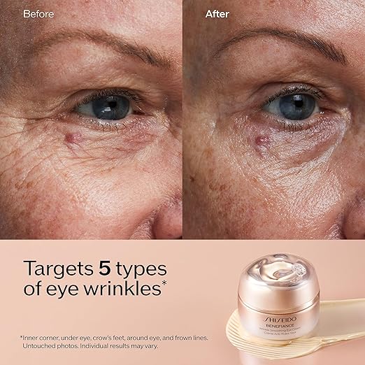 Before and after comparison of eye wrinkles with Shiseido Benefiance cream.