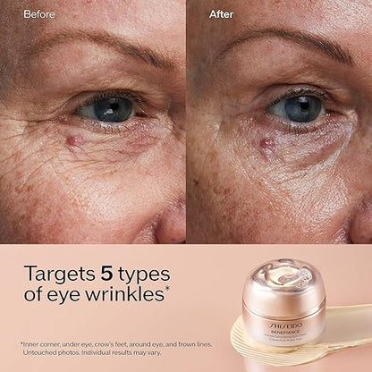 Before and after comparison of eye wrinkles with Shiseido Benefiance cream.