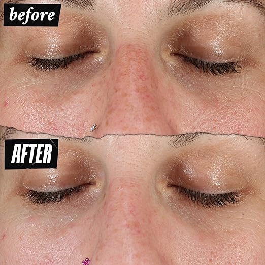 Kiehl's Clearly Corrective Dark Spot Solution