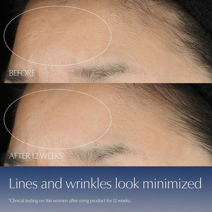 Before and after comparison of lines and wrinkles on a person's forehead with text indicating improvement after 12 weeks of use.