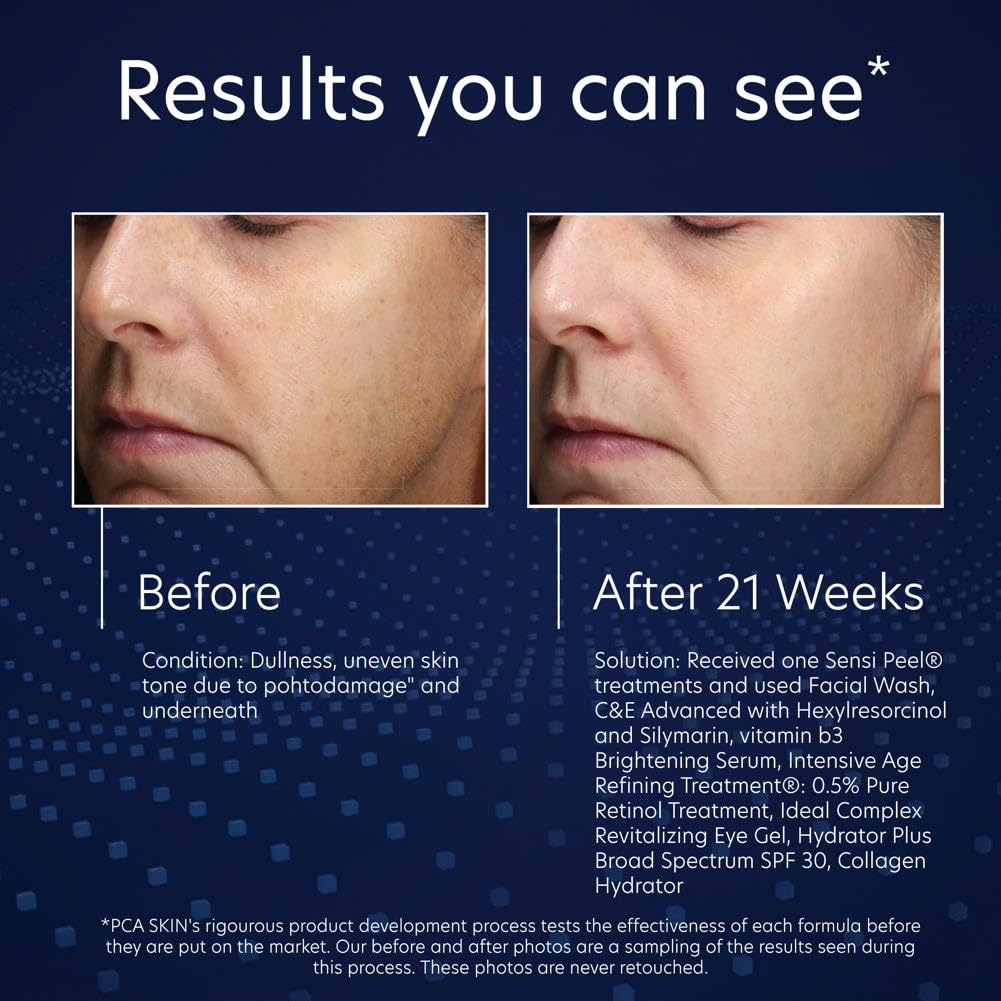PCA SKIN Vitamin B3 Brightening Serum – 1.0 Pump
