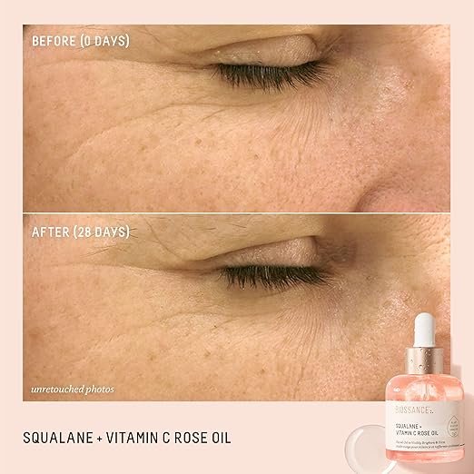 Before and after comparison of skin with a dropper bottle labeled 'Squalane + Vitamin C Rose Oil' on a beige background.