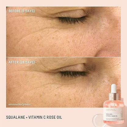 Before and after comparison of skin with a dropper bottle labeled 'Squalane + Vitamin C Rose Oil' on a beige background.