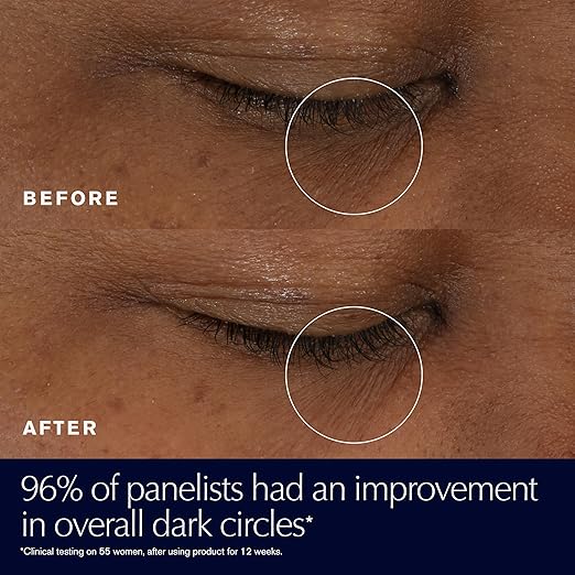 Estée Lauder Advanced Night Repair Eye Supercharged Gel‑Cream – Dark Circle Treatment (0.5 oz)