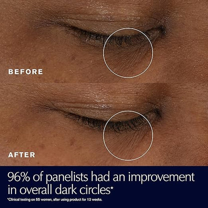 Before and after under‑eye comparison after using Estée Lauder Advanced Night Repair Eye Gel‑Cream