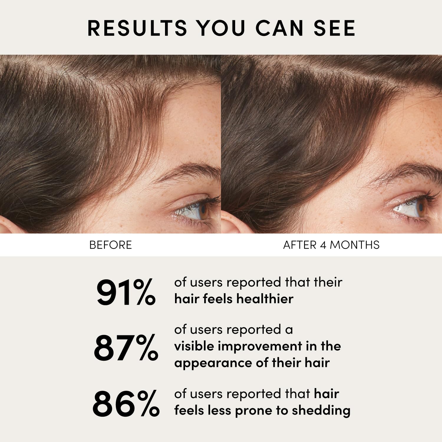 Before and after comparison of hair health with user-reported statistics on a beige background.