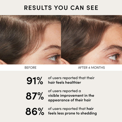 Before and after comparison of hair health with user-reported statistics on a beige background.