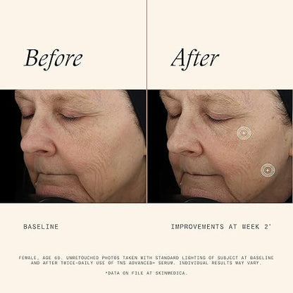 Before and after comparison of a woman's face with visible improvements at week 2, using an advanced serum.